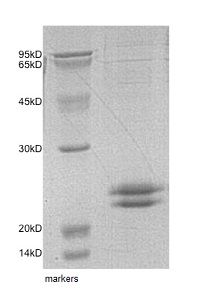 SDS-PAGE - Recombinant Human VMO1 protein (AB153791)