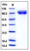 SDS-PAGE - Recombinant Human VNN1/Vanin-1 protein (His tag) (AB276420)