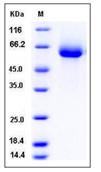SDS-PAGE - Recombinant Human VNN2 protein (His tag) (AB276424)