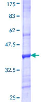 SDS-PAGE - Recombinant Human VNN3 protein (AB163077)