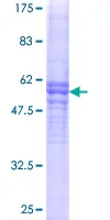 SDS-PAGE - Recombinant Human Von Willebrand Factor protein (GST tag N-Terminus) (AB152801)