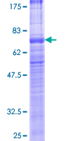 Recombinant Human VPAC2 protein