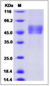 SDS-PAGE - Recombinant Human VPAC2 protein (Fc Chimera) (AB276613), expandable thumbnail