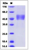 SDS-PAGE - Recombinant Human VPAC2 protein (Fc Chimera) (AB276613)