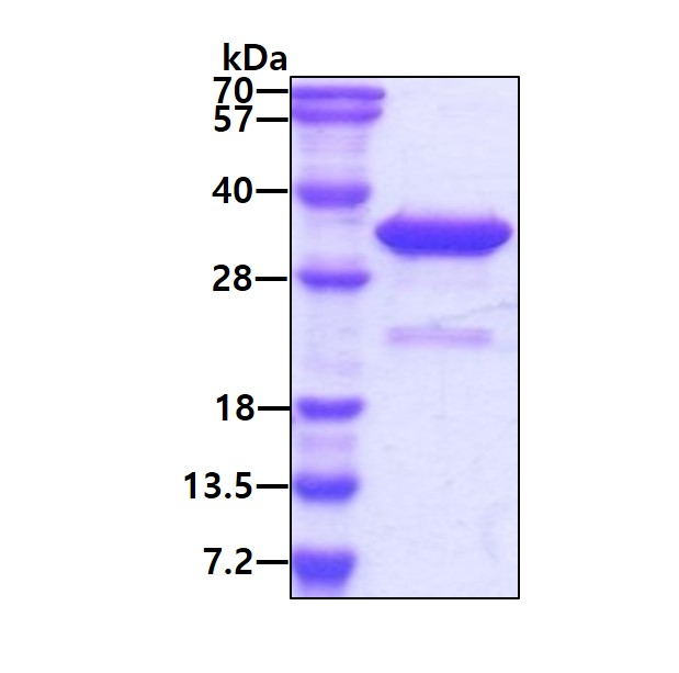 SDS-PAGE - Recombinant Human VPS24 protein (His tag N-Terminus) (AB109845)