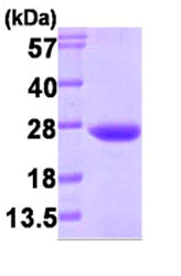 SDS-PAGE - Recombinant Human VPS28 protein (AB87718)
