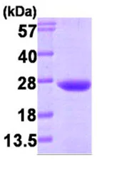 SDS-PAGE - Recombinant Human VPS28 protein (AB87718)