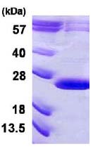 Recombinant Human VPS29 protein