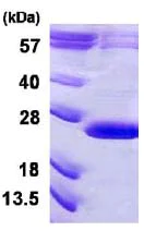 SDS-PAGE - Recombinant Human VPS29 protein (AB124582)