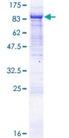SDS-PAGE - Recombinant Human VPS33B protein (AB132028)