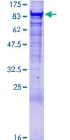 SDS-PAGE - Recombinant Human VPS35 protein (GST tag N-Terminus) (AB132953)