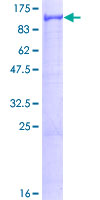 Recombinant Human VPS41 protein