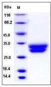 SDS-PAGE - Recombinant Human VSIG2 protein (His tag) (AB276403)