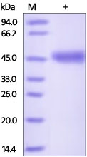 Sandwich ELISA - Recombinant Human VSIG4 protein (AB182716), expandable thumbnail