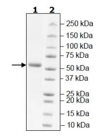 SDS-PAGE - Recombinant Human VSIG8 protein (Fc tag C-Terminus + Avi tag C-Terminus) (AB271791)