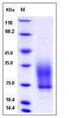 SDS-PAGE - Recombinant Human VSTM1 protein (His tag) (AB276506), expandable thumbnail