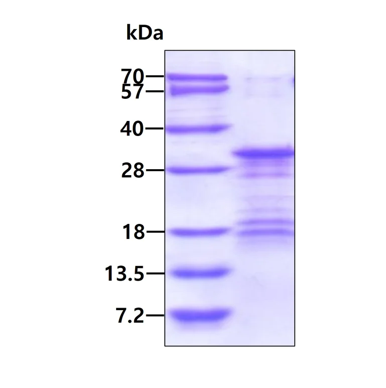 SDS-PAGE - Recombinant Human VTI1B protein (His tag N-Terminus) (AB126685)