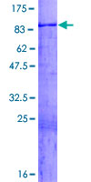 SDS-PAGE - Recombinant Human WASF3 protein (AB161165), expandable thumbnail