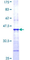 SDS-PAGE - Recombinant Human WASP/Wiskott-Aldrich syndrome protein (GST tag N-Terminus) (AB152802)