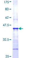 SDS-PAGE - Recombinant Human WASP/Wiskott-Aldrich syndrome protein (GST tag N-Terminus) (AB152802)