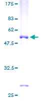 SDS-PAGE - Recombinant Human WBSCR22 protein (AB165013)