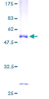 SDS-PAGE - Recombinant Human WBSCR22 protein (GST tag N-Terminus) (AB165013)