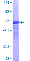 SDS-PAGE - Recombinant Human WDR5B protein (GST tag N-Terminus) (AB162780)
