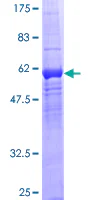 SDS-PAGE - Recombinant Human WDR5B protein (AB162780)
