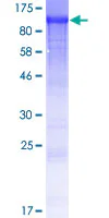 SDS-PAGE - Recombinant Human WDR62 protein (GST tag N-Terminus) (AB166176)