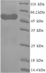 SDS-PAGE - Recombinant Human WDR77 protein (Tagged) (AB226226)