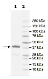 SDS-PAGE - Recombinant Human WDR9/BRWD1 protein (AB195164)