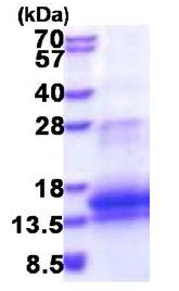 SDS-PAGE - Recombinant Human WFDC12 protein (AB177599), expandable thumbnail