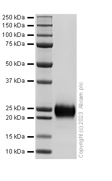 SDS-PAGE - Recombinant Human WFDC2 Protein (His tag) (AB313361)