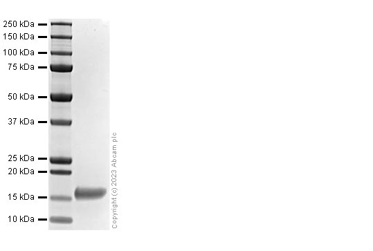 SDS-PAGE - Recombinant Human WFDC2 Protein (His tag) (E.Coli) (AB313367), expandable thumbnail