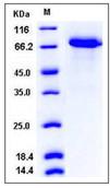 SDS-PAGE - Recombinant Human WFIKKN2 protein (His tag) (AB276451)