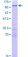 SDS-PAGE - Recombinant Human WHSC1/NSD2 protein (GST tag N-Terminus) (AB159810)