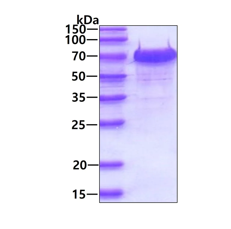 SDS-PAGE - Recombinant Human WHSC2/NELF-A protein (AB116197)