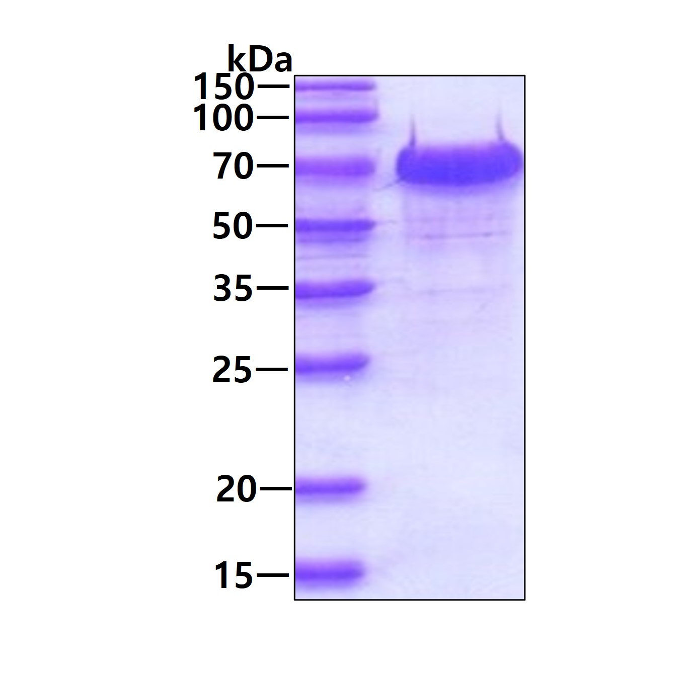 SDS-PAGE - Recombinant Human WHSC2/NELF-A protein (His tag N-Terminus) (AB116197)
