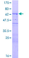 SDS-PAGE - Recombinant Human WIPF1 protein (GST tag N-Terminus) (AB132512)