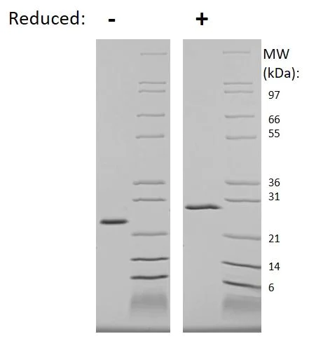 SDS-PAGE - Recombinant Human WISP2 protein (AB269159)