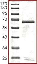 SDS-PAGE - Recombinant human WNK1 protein (AB105196)