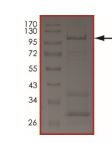 Recombinant human WNK2 protein (Active)