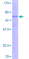 Recombinant Human Wnt2b protein