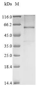 SDS-PAGE - Recombinant Human Wnt2b protein (AB289754)