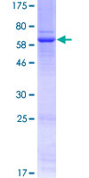Recombinant Human Wnt3 protein