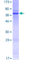 SDS-PAGE - Recombinant Human Wnt3 protein (AB132336)