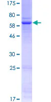 SDS-PAGE - Recombinant Human Wnt3 protein (GST tag N-Terminus) (AB132336)
