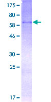 Recombinant Human Wnt3a protein