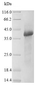 SDS-PAGE - Recombinant Human Wnt5a protein (His tag) (AB236199), expandable thumbnail