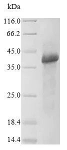 SDS-PAGE - Recombinant Human Wnt5a protein (His tag) (AB236199)
